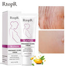 Creme Revitalizador Removedor de Estrias e Cicatrizes